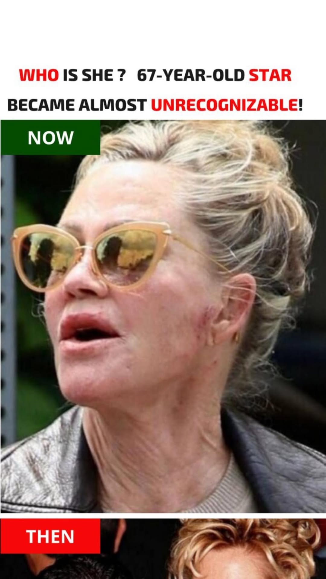 Fans were shocked when a paparazzi photo revealed the 67-year old, who was almost unrecognizable.
