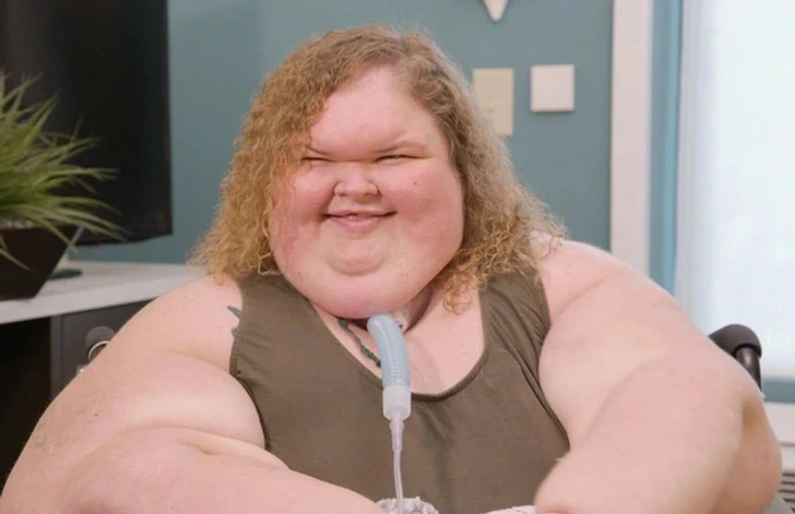 “Proud of You,” 1000-lb Sisters Star’s Incredible Before and After Skin Removal Surgery