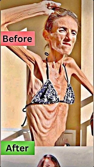 Doctors Had Serious Concerns About Her Health — What Happened Next Surprised Many